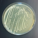 Illustration for article titled Scientists Have Hacked Yeast to Produce Narcotics